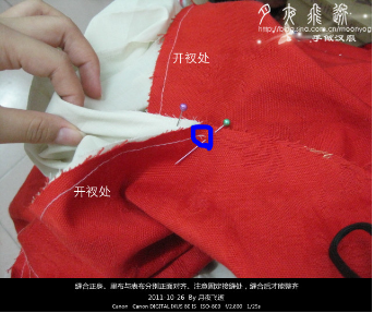 注意。缝合的止点